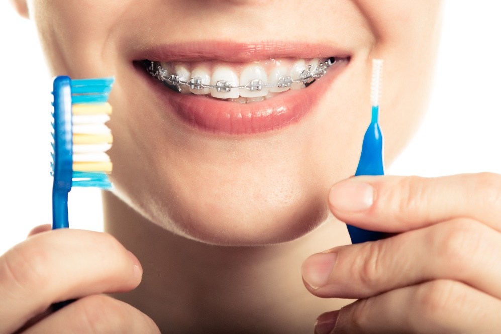 The Best 4 Ways to Clean Your Retainer - Central Coast Orthodontics